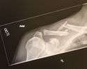 initial xray damage~0.jpg